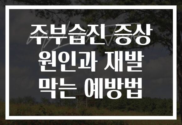 주부습진 증상 원인과 재발 막는 예방법