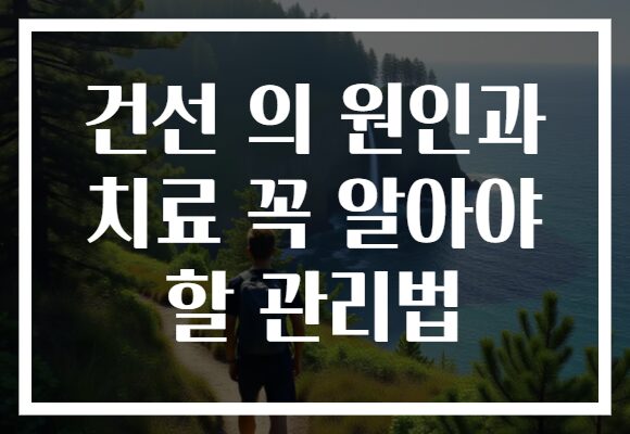 건선 의 원인과 치료 꼭 알아야 할 관리법